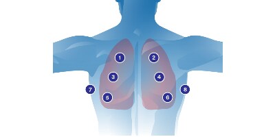 Schéma d’auscultation pulmonaire
