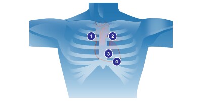 Diagramme d’auscultation cardiaque
